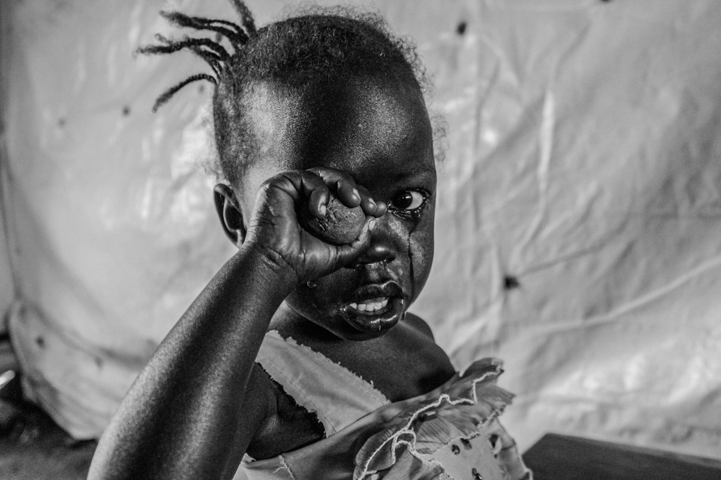 A young girl cries after medical inspection in Kulaba reception centre, where new arrivals are vaccinated against diseases.Women and children make up more than 80% of people arriving from South Sudan.